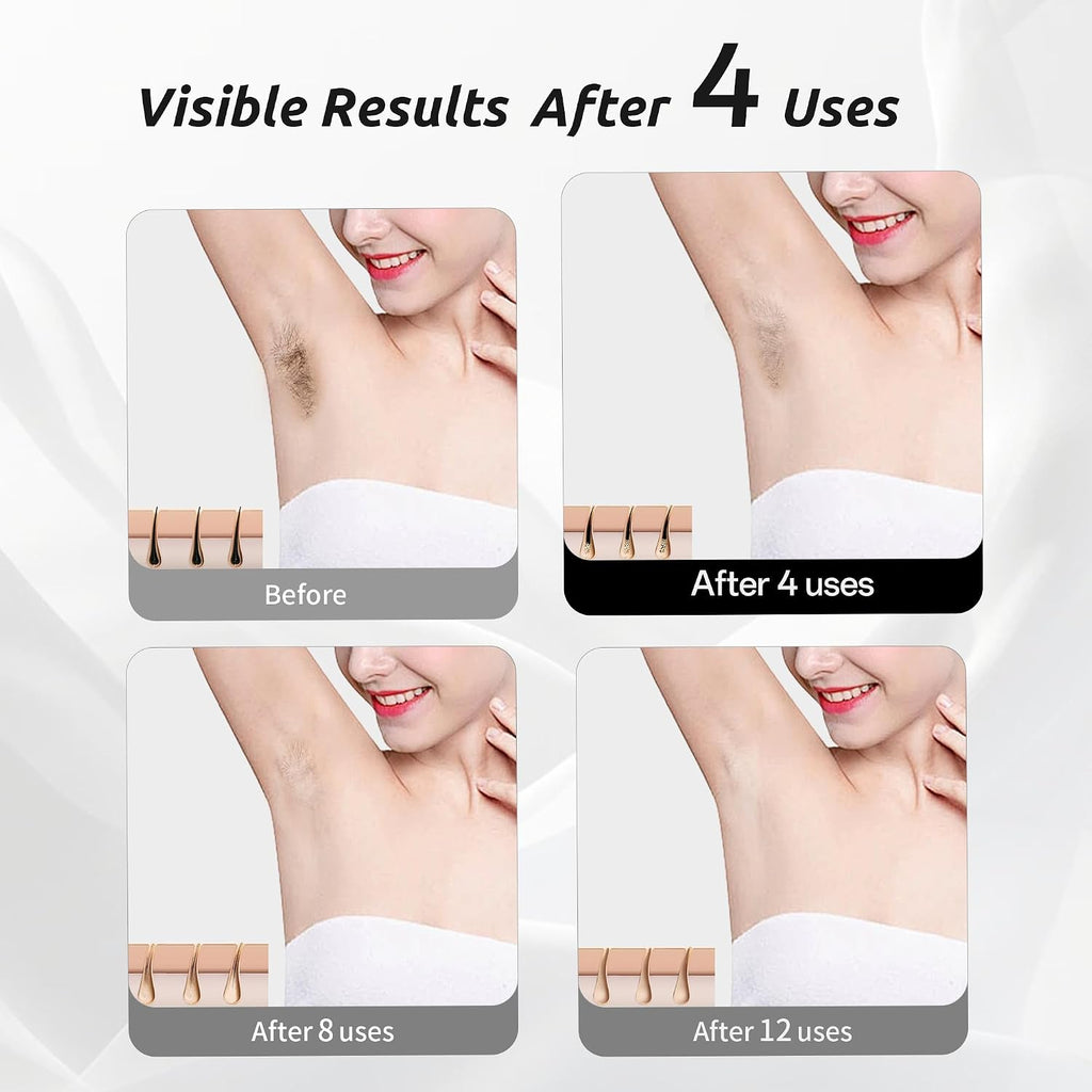 Laser Hair Removal Device for Women and Men, IPL Painless Sapphire with 40F Ice-Cooling System, Safe, Long-Lasting Hair Removal for Home, Face, Legs, Back, Bikini Line